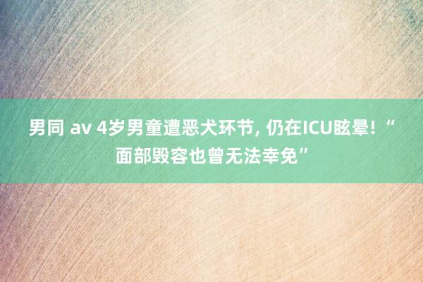 男同 av 4岁男童遭恶犬环节， 仍在ICU眩晕! “面部毁容也曾无法幸免”